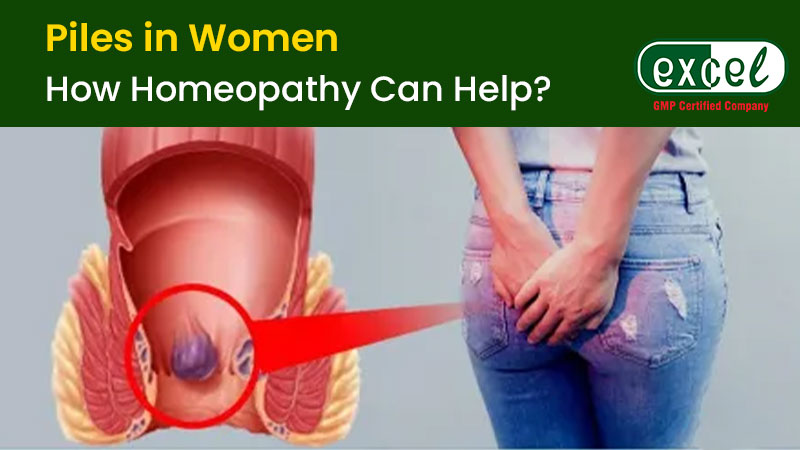 Homeopathic Medicine for Piles