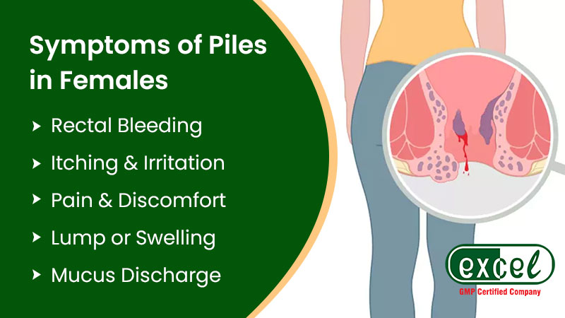 Symptoms of Piles in Females